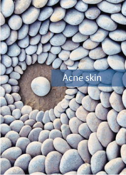 Acne skin